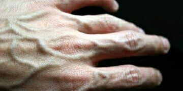 Why veins appear visibly on some people’s skins