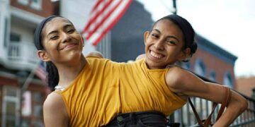 What happens to conjoined twins if one of them dies?