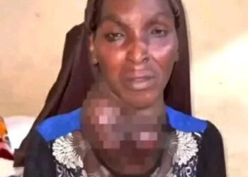 Osun Woman Who Chose N300,000 Cash Over Goitre Operation Dies