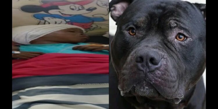 5 year old girl attacked by dog in Ibadan survived after surgery