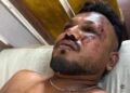 New Footage Shows Sole Survivor of Air India Crash Calmly Walking Away as Plane Explodes (WATCH)
