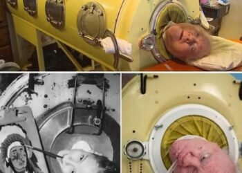 Paul Alexander, ‘The Man in the Iron Lung,’ Dies After 70 Years in Mechanical Respirator